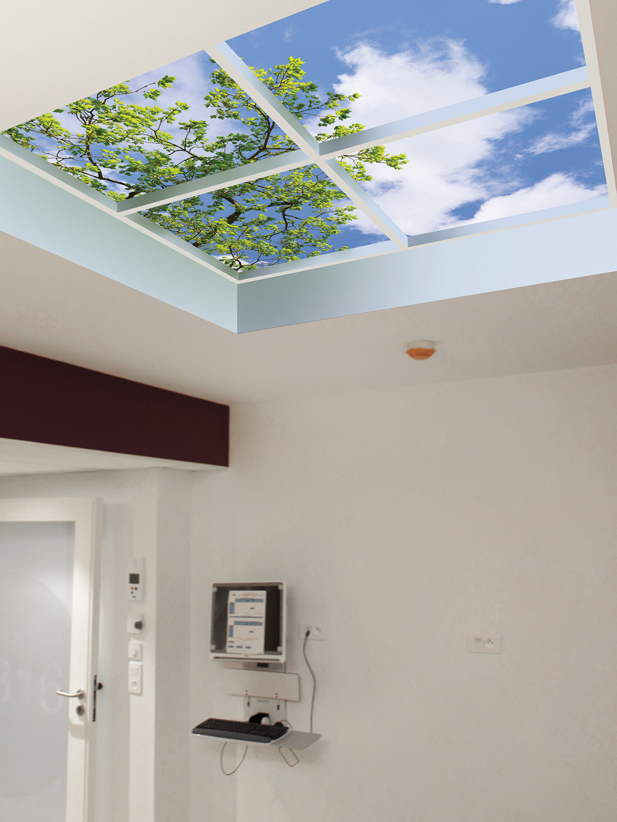 Luminous SkyCeiling (sky ceiling) reduce treatment anxiety and distress in patients.